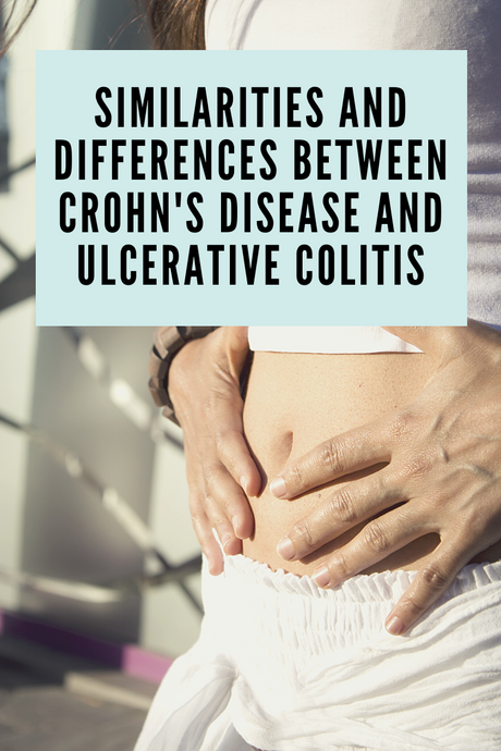 Similarities and Differences between Crohn's Disease and Ulcerative Colitis